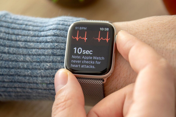 Функция ЭКГ появится на Apple Watch в России. Кому и когда ждать?